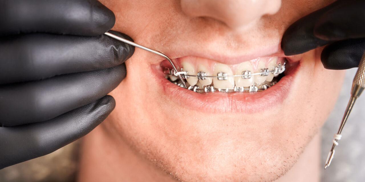 Безкоштовна консультація ортодонта